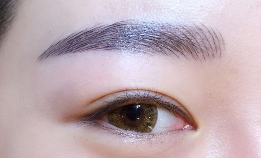 徐利剛：杭州藝星整形臨床實力派！鼻子整形解析，案例詳解！