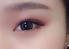 蔣小花醫(yī)生手術(shù)的實際操作方法和評價分享，多樣風(fēng)格消解揭秘！