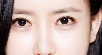 益陽市中心醫(yī)院整形科去除眼袋獨(dú)創(chuàng)新方式2023案例解析