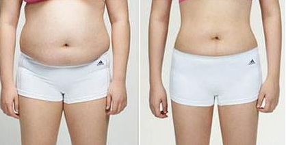 西安最佳眼整形醫(yī)院推薦！獨享晶膚、美萊、西京等專業(yè)醫(yī)療服務