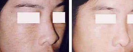 福州美貝爾醫(yī)療美容門診部：薛欣醫(yī)生用戶評價(jià)高？真實(shí)案例分享！