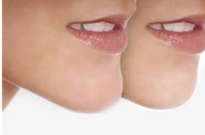 成都頂尖的玻尿酸注射醫(yī)生排行榜，六位信譽好的醫(yī)生介紹