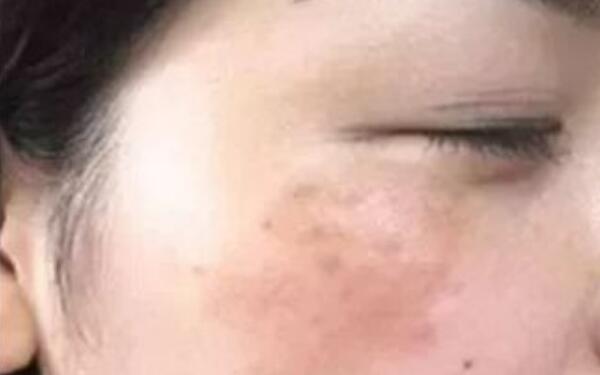 珠海美南華醫(yī)療美容醫(yī)院值得信賴嗎？效果怎么樣？