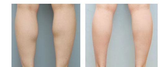 尋找蘇州市最佳雙眼皮整形醫(yī)生，專家排行榜最新發(fā)布