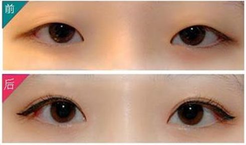 深圳美萊郭杰整形技術(shù)分析及專(zhuān)家背景揭秘