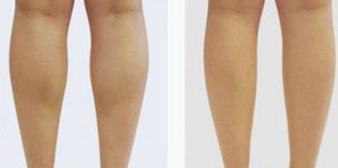 北京八大處楊欣好評傳遍朋友圈！揭秘90天顛覆性隆鼻之旅