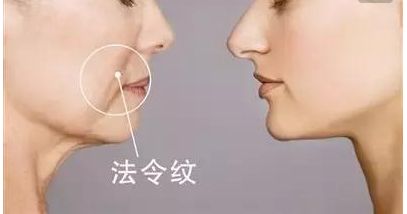 韋元強swan吸脂修復(fù)方法介紹，相關(guān)醫(yī)院推薦