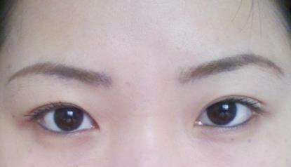 北京明會(huì)紅醫(yī)療美容診所價(jià)格表真實(shí)嗎？你會(huì)不會(huì)覺得有點(diǎn)匪夷所思？