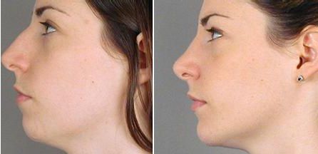 山東頂級(jí)整容醫(yī)院推薦！專業(yè)醫(yī)療機(jī)構(gòu)盤(pán)點(diǎn)，你值得擁有