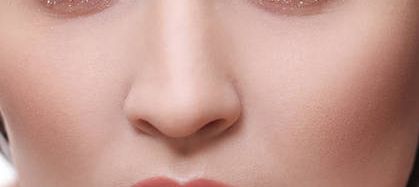 李湘源隆鼻案例，技術(shù)與反饋圖及價格表分享！