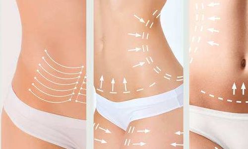 2023年武漢吸脂抽脂醫(yī)生（專家）技術(shù)分享：張軍、張繼強、劉洋等探討