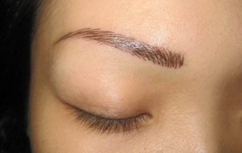 上海伯思立王艷隆鼻效果怎么樣？肋軟骨隆鼻真實(shí)案例及收費(fèi)一覽