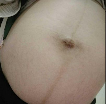 揭示濰坊市熱門隆鼻醫(yī)院排行榜！尋找濰坊隆鼻首選醫(yī)療機(jī)構(gòu)TOP10！