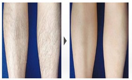 2023年醫(yī)療美容門戶,了解成都整形醫(yī)院實(shí)力，權(quán)威機(jī)構(gòu)匯總