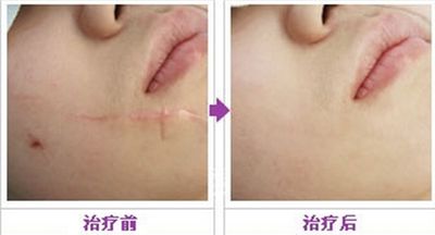 重慶神奇醫(yī)療機(jī)構(gòu)，致力于脂肪填充醫(yī)療服務(wù)的機(jī)構(gòu)盤點(diǎn)