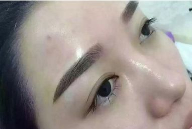 成都哪些整形醫(yī)院在皮膚美容領(lǐng)域具備優(yōu)勢？