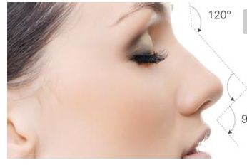 無錫二院隆鼻效果及費用情況詳解，醫(yī)生分享成功案例