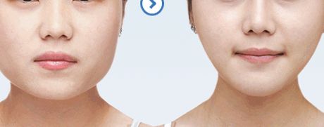 461醫(yī)院植牙科綜合評(píng)測(cè)：醫(yī)生隊(duì)伍強(qiáng)大，成功案例豐富，價(jià)格表詳解