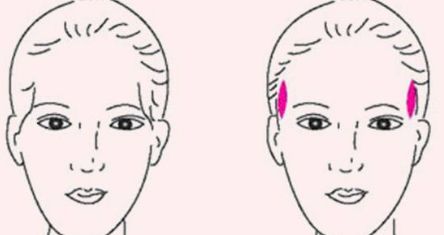 成都軍大醫(yī)院外切眼袋手術效果及評價分析