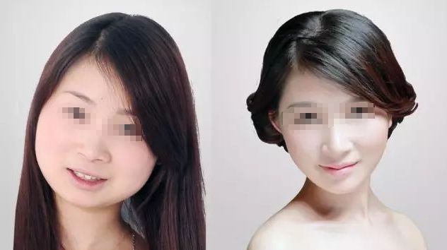 沈陽口碑優(yōu)秀的鼻部整形診所推薦