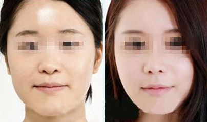 優(yōu)質修復妊娠紋服務中心推薦