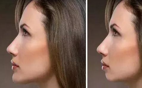 重慶地區(qū)哪家整容醫(yī)院聲譽良好，新版排行榜公布，等你來挑選