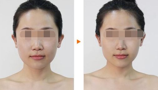 廣州哪家整形醫(yī)院好？排名前十值得推薦