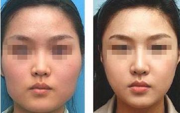 南通瘦身整形醫(yī)院哪家專業(yè)？