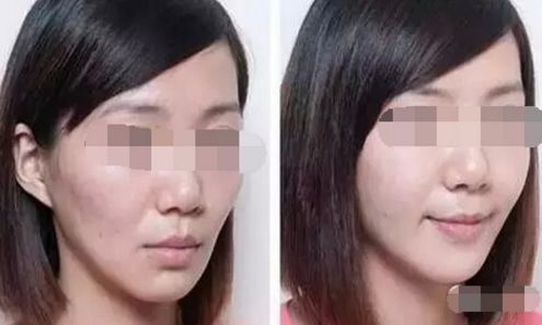 北京哪些醫(yī)院能進行吸脂手術？