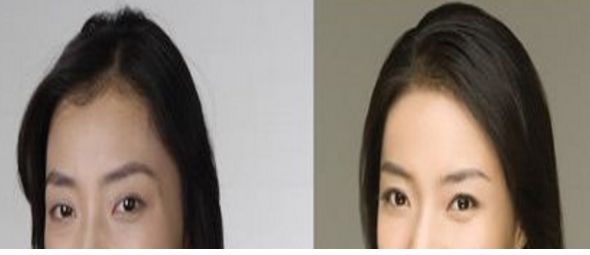 成都悅己醫(yī)美醫(yī)生實(shí)力強(qiáng)，顧客口碑好價(jià)格合適