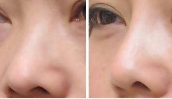 湖南熱瑪吉整形醫(yī)院綜合實(shí)力前五名亮相