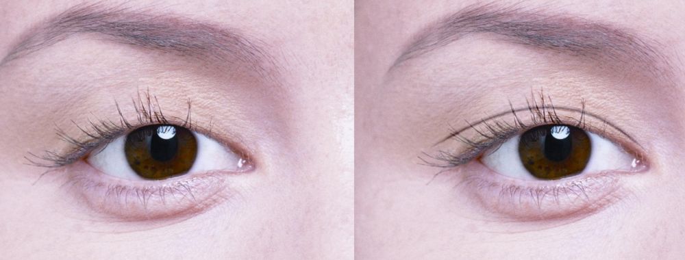 鄭州市那家醫(yī)院割雙眼皮效果好，口碑贊不絕口！