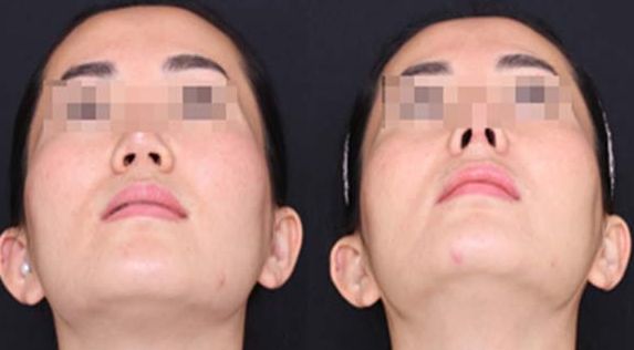 蘭州經(jīng)驗(yàn)豐富的脂肪豐胸醫(yī)生推薦：逯巖、郭曉磊、雷蓓