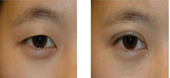 武漢最好的整形美容醫(yī)院哪家？