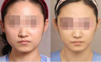 湛江有哪些頂尖整形美容醫(yī)院值得關(guān)注？