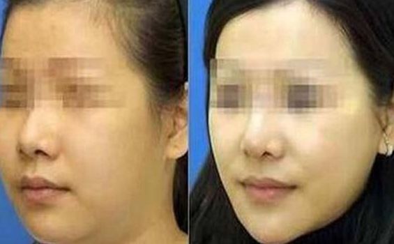 優(yōu)質(zhì)貴陽(yáng)隆胸醫(yī)院排行榜公布，這五家醫(yī)院值得關(guān)注