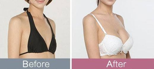 東莞哪家整形醫(yī)院頗受推薦？