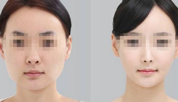 湖南省隆鼻整形醫(yī)院排行榜發(fā)布！哪家整形醫(yī)院效果好又靠譜？