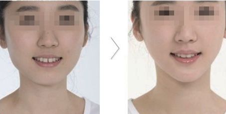 哪家醫(yī)院在北京具有卓越的醫(yī)美科技和服務？歐洲醫(yī)學中心、北京協(xié)和、北大人民醫(yī)院等公立單位有何特色？