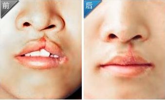 雅典娜美容診所價目公布及醫(yī)生簡介【更新】