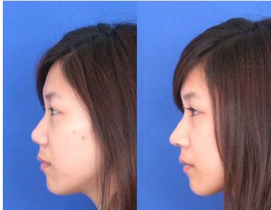 福州地區(qū)頂級整形醫(yī)院推薦