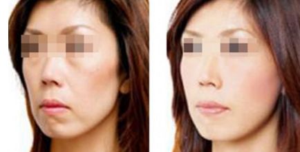 成都頂尖整形醫(yī)院評(píng)價(jià)如何？