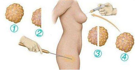 東莞華美醫(yī)療美容門診部綜合評價及價格公示