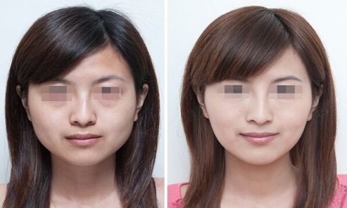 煙臺(tái)市三甲整形醫(yī)院排名匯總，哪家好？