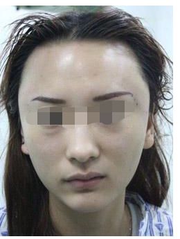 北京嘉禾整形24小時電話預約攻略