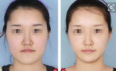 舒緩按摩，喚醒肌膚活力光彩