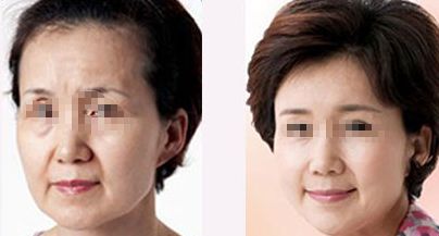 珠海整形醫(yī)院哪家好？排名榜前五都有哪些醫(yī)院？