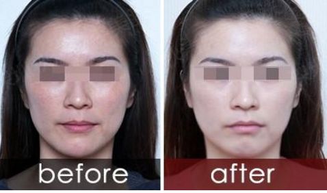 2024年濟南微整醫(yī)院10強排行榜