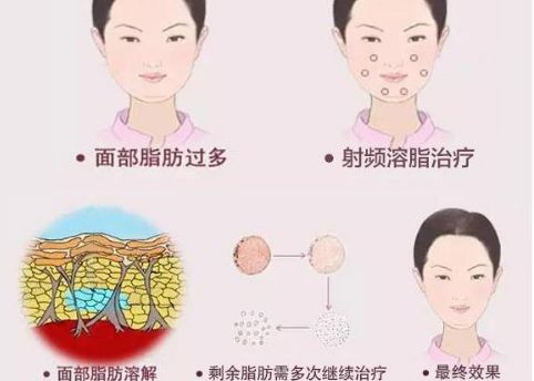 徐州二院整形美容科專家評(píng)價(jià)及服務(wù)項(xiàng)目介紹，陶常波醫(yī)生特長(zhǎng)領(lǐng)域一覽