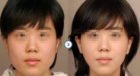 【揭秘】合肥私立整形醫(yī)院人氣TOP榜單！